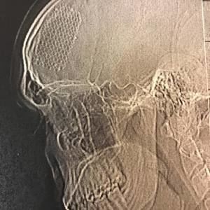 Meet your Posher, Thomas